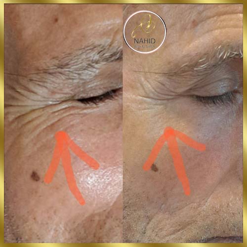 گالری پاکسازی پوست